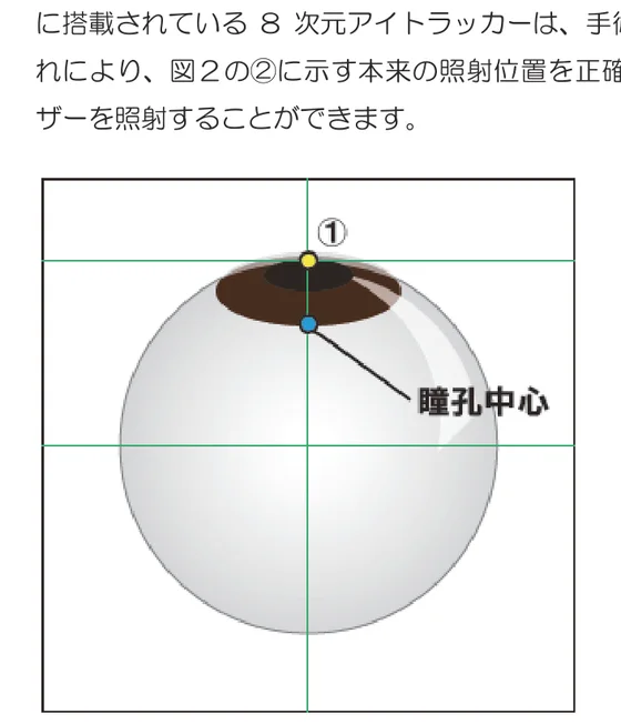 図1：眼が正面を向いた状態の瞳孔中心
